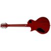 ALEX SKOLNICK LEMON BURST